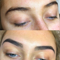 HD Brows Treatment